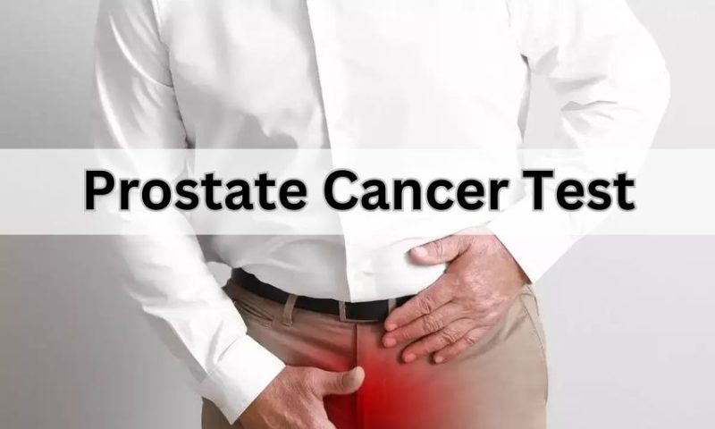Prostate Cancer Test Cost: A Complete Guide