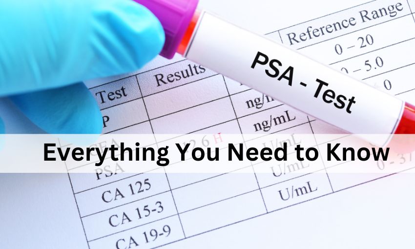 PSA Test Cost