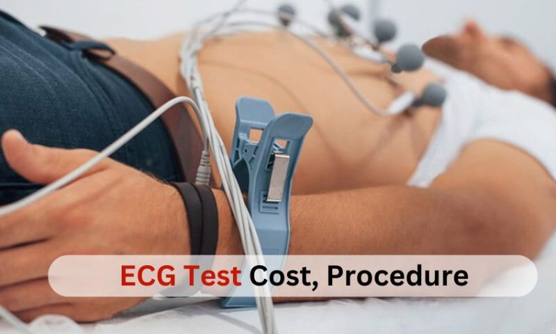What is ECG Test Cost, Procedure and Normal Range