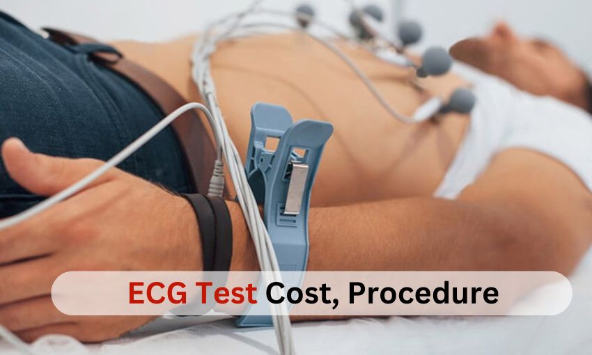 ECG Test Cost