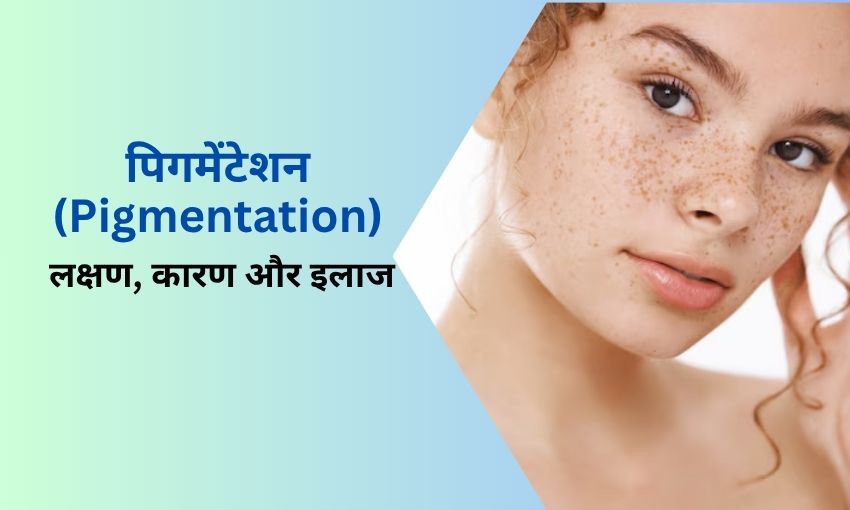 treatment of pigmentation in hindi