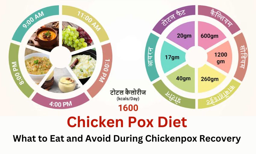 Chicken Pox Diet