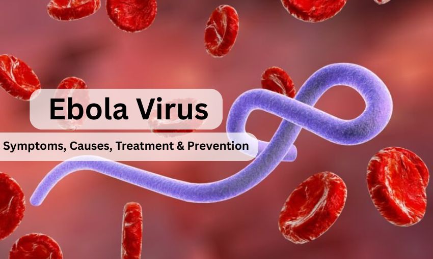 ebola virus disease