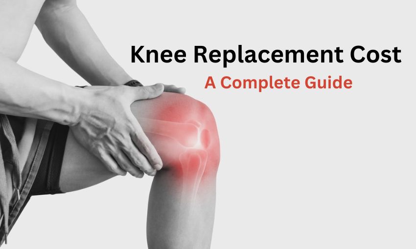 Cost of Knee Replacement Surgery