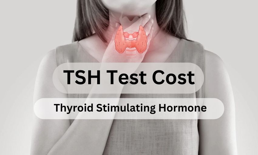 TSH Test Cost- Thyroid Stimulating Hormone Price Details