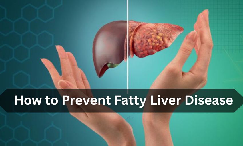 How to Prevent Fatty Liver Disease: Simple Tips for a Healthy Liver