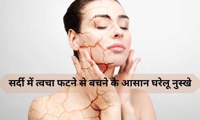 सर्दी में त्वचा फटने से बचने के घरेलू नुस्खे- Winter Skin Care