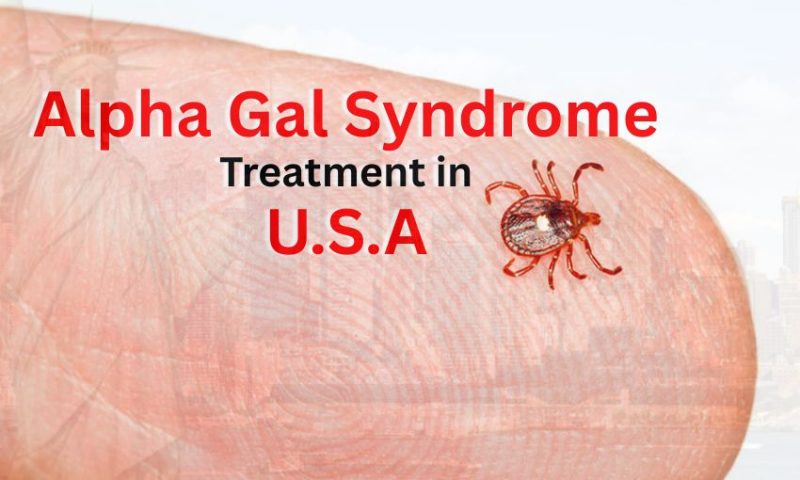 Alpha Gal Syndrome Treatment in USA – Causes & Symptoms