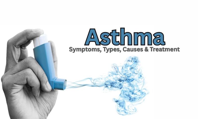 Asthma: Symptoms, Types, Causes & Best Treatment Guide
