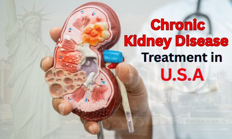 Chronic Kidney Disease Treatment in USA | Stages & Symptoms