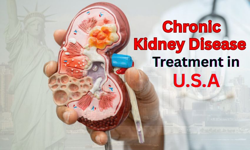 Chronic Kidney Disease Treatment in USA | Stages & Symptoms
