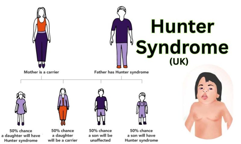 Hunter Syndrome in UK – Causes, Symptoms & Treatment Guide