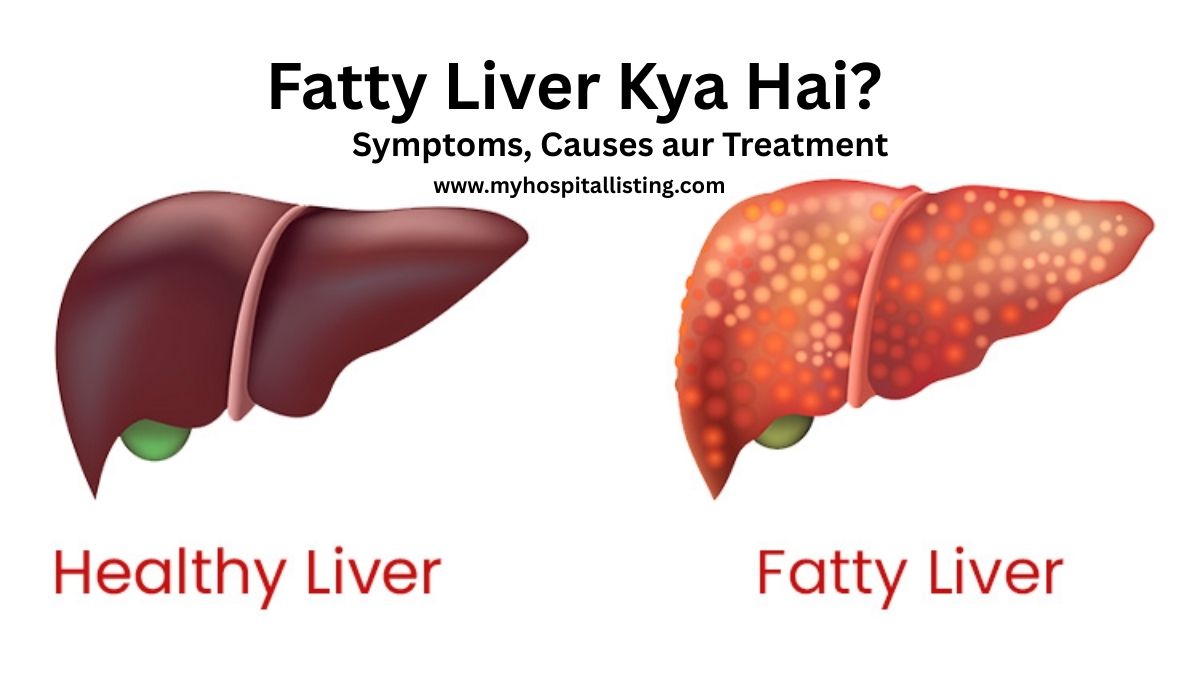 Fatty Liver Kya Hai? Symptoms, Causes aur Treatment in Hindi