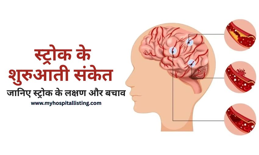 Brain Stroke Kya Hota Hai -स्ट्रोक के लक्षण, कारण और बचाव की पूरी जानकारी